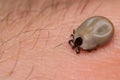 Fat tick on human skin