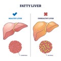Fatty liver disease with healthy and damaged organ comparison outline diagram