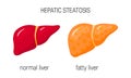 Hepatic steatosis concept Royalty Free Stock Photo