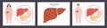 Liver disease concept Royalty Free Stock Photo