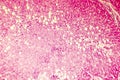 Light micrograph of a fatty liver Royalty Free Stock Photo