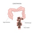 Fecal obstruction and gas accumulation in the intestines