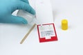 Fecal Sample Test