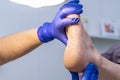 Feet with dry skin, cracked heels, podiatrist examining patient
