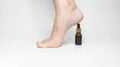 Feet with dry skin before oil treatment. Woman foot with an esential oil bottle as a heel Royalty Free Stock Photo