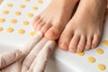 Feet with fungal toe nail infection Royalty Free Stock Photo