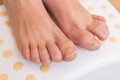Feet with fungal toe nail infection Royalty Free Stock Photo