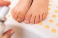 Feet with fungal toe nail infection Royalty Free Stock Photo
