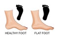Feet healthy and flat feet. footprint