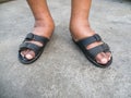 The feet of man with diabetes, dull and swollen. Due to the toxicity of diabetes. Foot swelling caused by drinking water.