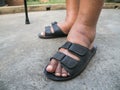 The feet of man with diabetes, dull and swollen. Due to the toxicity of diabetes. Foot swelling caused by drinking water. Royalty Free Stock Photo