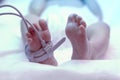 Feet of new born baby under ultraviolet lamp