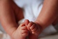 Feet of a newborn baby boy without socks clubfoot Royalty Free Stock Photo