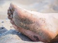 Feet of one unrecognizable caucasian person resting in sand Royalty Free Stock Photo