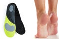 Feet and orthopedic insoles