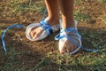 Feet of poor girl covered with shoe