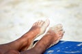 Feet of sunburnt woman on beach