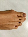 Feet, toes, body part, bunions Royalty Free Stock Photo