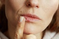 Female applying ointment using finger on beige