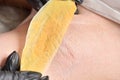 Female armpit and torn hair in wax for depilation. Waxing Royalty Free Stock Photo