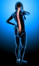 Female back pain