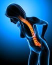 Female back pain