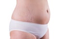 Female belly with stretch marks isolated on white background Royalty Free Stock Photo