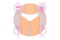 Female body in lingerie and icons with different type and tool for epilation Royalty Free Stock Photo