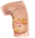 Breast and axillary Lymph nodes