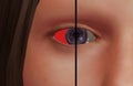 Female Blue Eye - One Sclera Red - One Sclera White