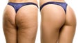 Female buttocks before and after cosmetics treatment Royalty Free Stock Photo