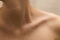 Female clavicles and neck with moles on the skin