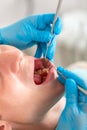 A female dentist examines the oral cavity of the patient with a tool with a mirror. Close-up portrait of a patient with Royalty Free Stock Photo