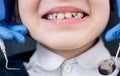 Female dentist examines the teeth of the patient child Royalty Free Stock Photo