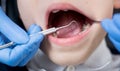 Female dentist examines the teeth of the patient child