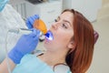 Female dentist fixed and dry dental fillings with light. Beautiful female dentist putting a filling on a tooth with caries of a