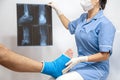 Bone fracture foot and leg on male patient being examined by a woman doctor in a hospital Royalty Free Stock Photo