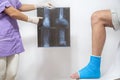 Bone fracture foot and leg on male patient being examined by a woman doctor in a hospital Royalty Free Stock Photo