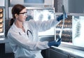 Female doctor check film x-ray image for patient medical care. Surgeon woman examining x-ray film of human body part then