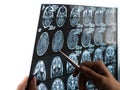 A female doctor examines an MRI scan of the brain. Royalty Free Stock Photo