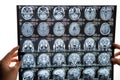 A female doctor examines an MRI scan of the brain. Royalty Free Stock Photo