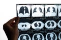 A female doctor examines an MRI scan of the internal organs. Abdomen. Royalty Free Stock Photo