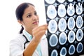 Female doctor examining a brain tomography scan