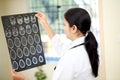 Female doctor examining a brain tomography scan Royalty Free Stock Photo