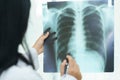 Female doctor examining about lungs with x-ray film - sick concept. Royalty Free Stock Photo