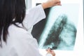 Female doctor examining about lungs with x-ray film - sick concept. Royalty Free Stock Photo