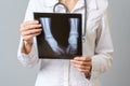 Female doctor examining x-ray image of legs of newborn baby Royalty Free Stock Photo