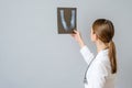 Female doctor examining x-ray image of legs of newborn baby Royalty Free Stock Photo