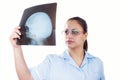 Female doctor examining x-ray image of the patients skul Royalty Free Stock Photo