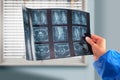 Female doctor holding and analyzes spine radiography